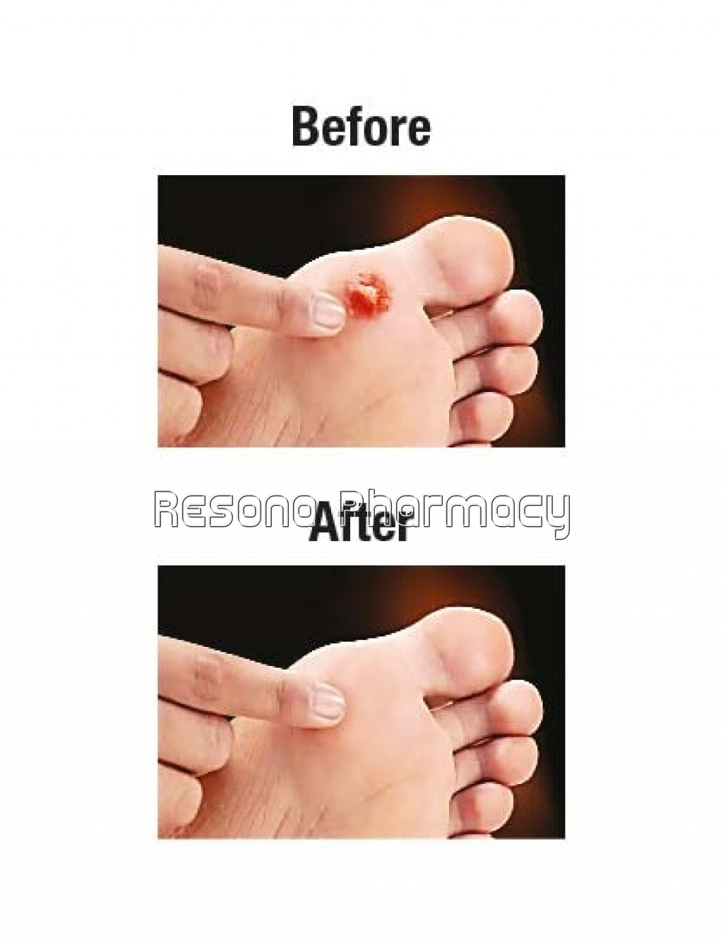 uploads/product/202209/main/RES000315_AMRUTANJAN CORN3_60326.jpg